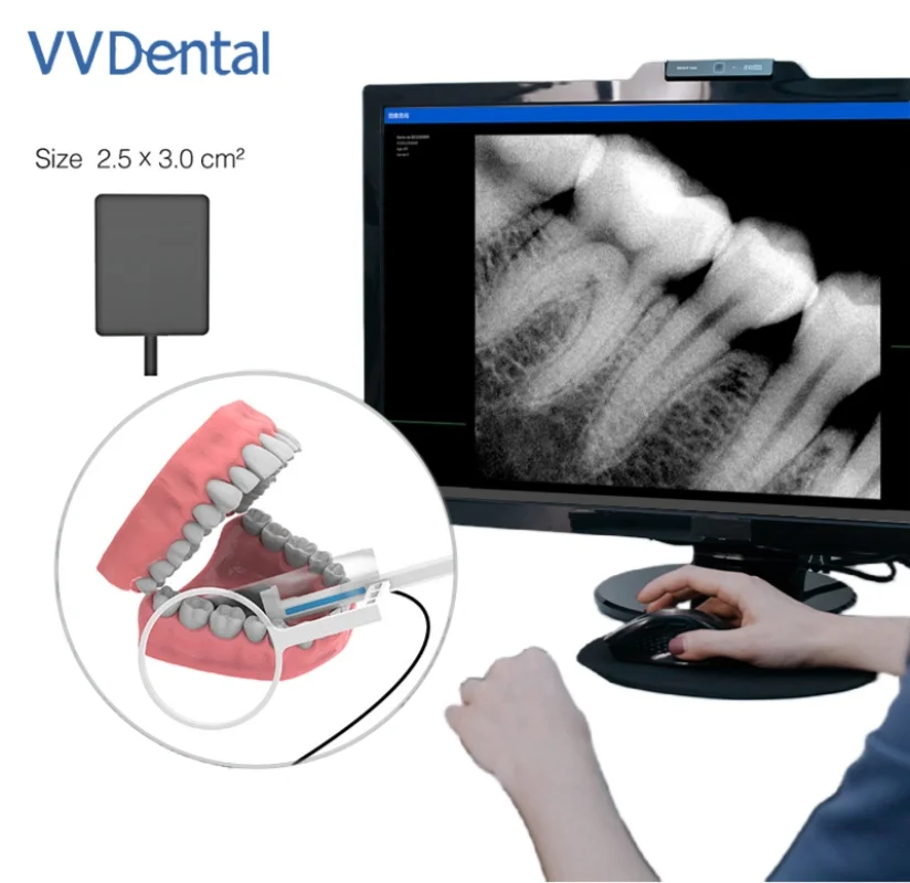 VV Dental Portable X Ray Sensor Kit Practical-Digital Sensor R1 0.8cm Intraoral HD Image System USB Connection Dentistry Sensor