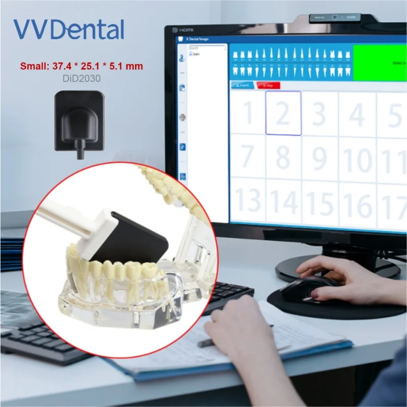 Dental X-ray Sensor lmaging Detector Digital Sensor w/ USB Connection HD lmage High-Frequency ray Radiovisiograph Dentistry Tool